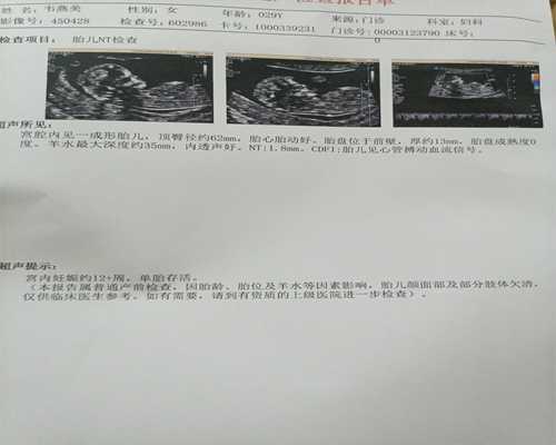 昆明的代孕费用,泰国试管婴儿价格有多贵？具体费用是多少？-上海供卵试管公